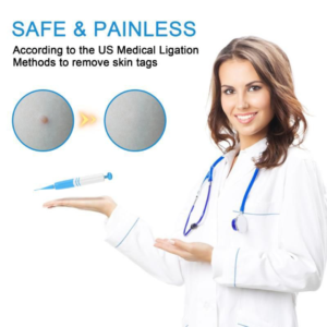 Skin Tag Remover - Safe, Natural, and Easy Home Treatment for All Areas